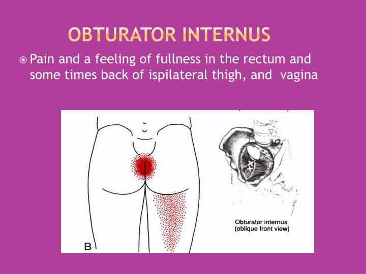PPT Interventional Approaches to pelvic pain in women PowerPoint