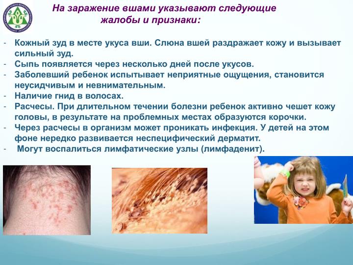 Как сделать чокер на шею своими руками (50 фото) Как понять без слов: улыбка и другие сигналы мимики