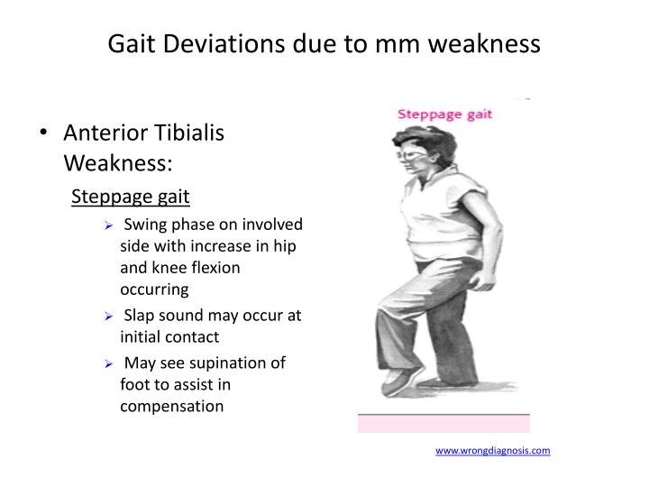 PPT - Ambulation Aids Normal Gait And Abnormal Gait PowerPoint ...