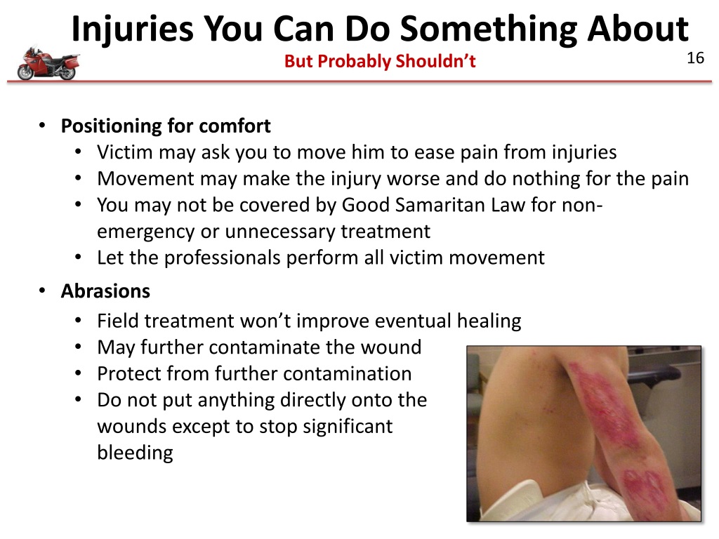 PPT - A Rider’s B een Injured In an Accident… What should I do ...
