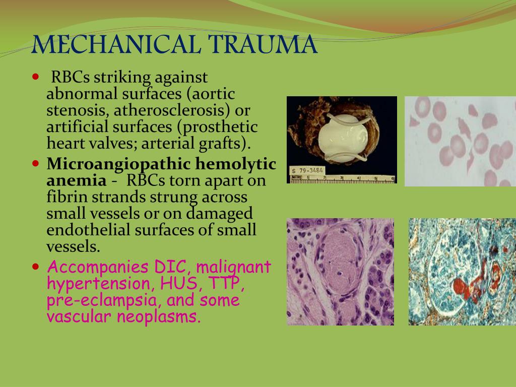 PPT Hematological Disorders In Pregnancy PowerPoint Presentation 