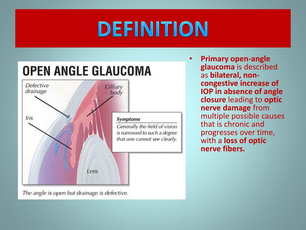 PPT - PRIMARY OPEN ANGLE GLAUCOMA(POAG) PowerPoint Presentation, free