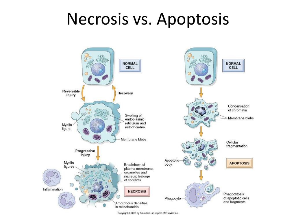 Необратимые изменения клетки. Апоптоз и некроз отличия. Апоптоз клетки схема. Апоптоз клетки стадии. Этапы апоптоза клетки.