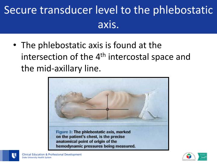 PPT Arterial Line Management for the Birthing Center PowerPoint