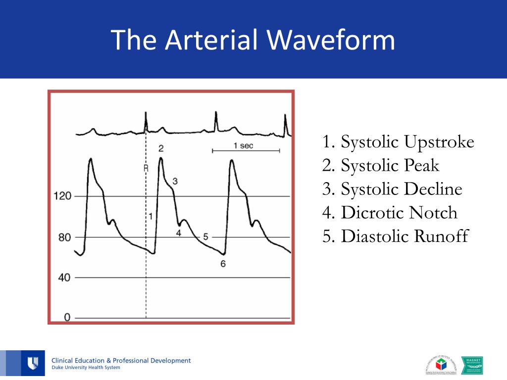 PPT Arterial Line Management for the Birthing Center