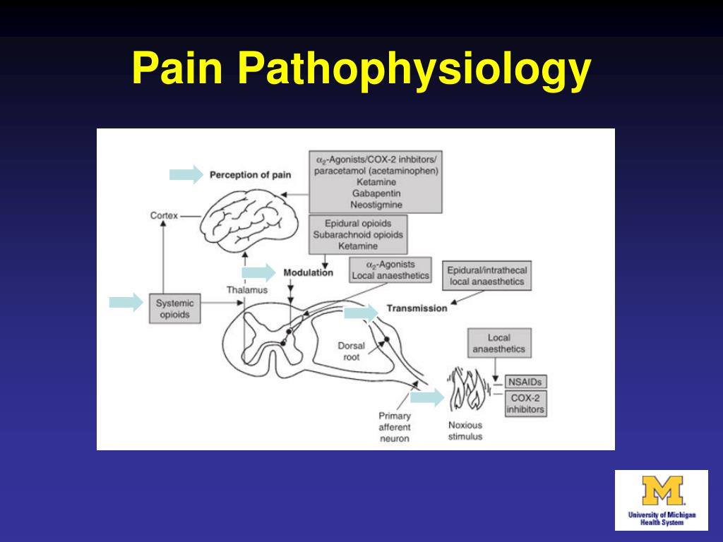 PPT  What’s New I n Acute Pain Management Reducing Our Dependence O n