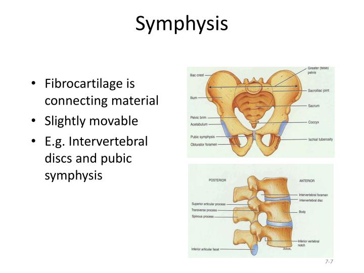PPT Classification Of Joints PowerPoint Presentation ID 1589838 ppt-classification-of-joints-powerpoint-presentation-id-1589838