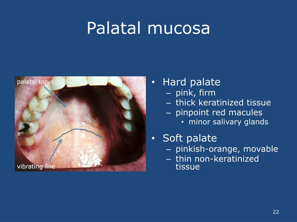 PPT David Reznik , DDS Oral Examinations for NonDental Clinicians