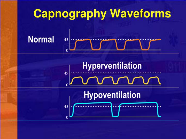 what point(s) on the capnographic waveform represents) a mixture of alveolar gas and dead space gas