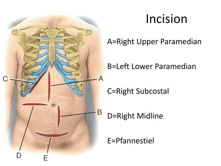 PPT - Surgical Wound Care PowerPoint Presentation - ID:1615782