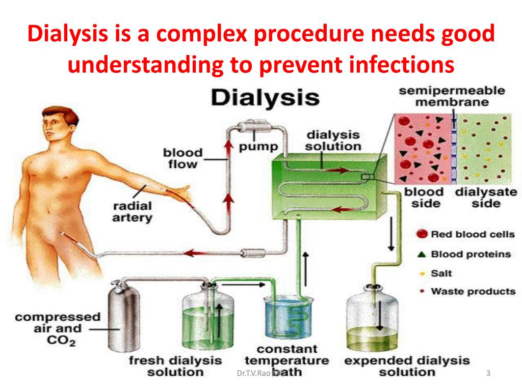 do-you-continue-to-make-urine-after-starting-dialysis