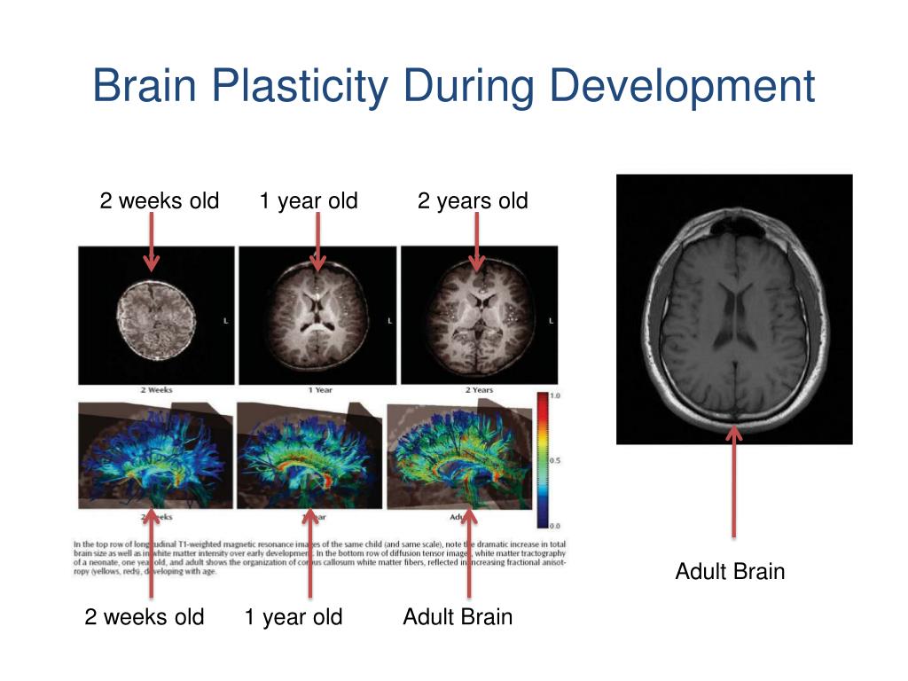 PPT Navigating School Re Entry After Traumatic Brain Injury A 