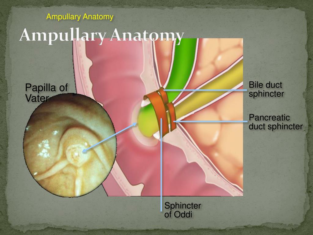 PPT - PANCREATITIS RICHARD L. MONES MD HARLEM HOSPITAL PowerPoint ...