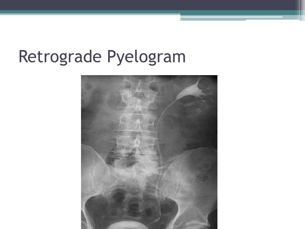 PPT Urology PowerPoint Presentation, free download ID1649237