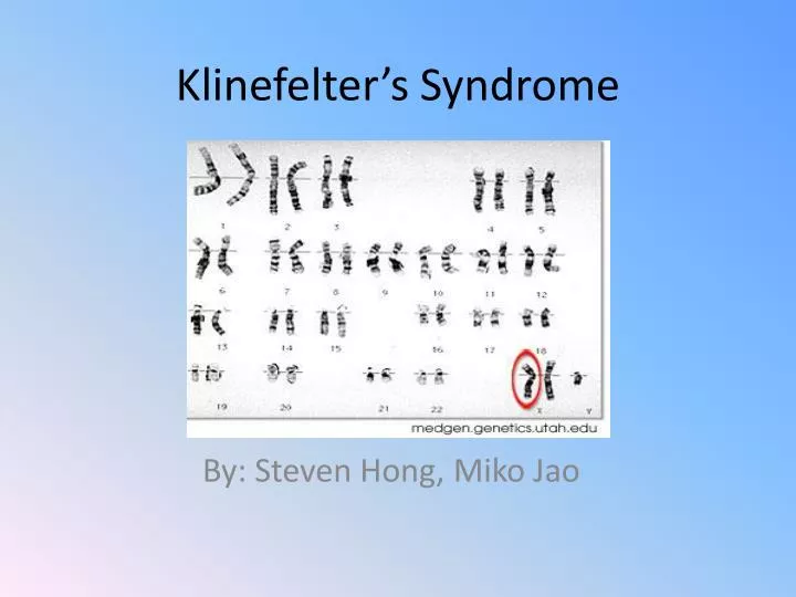 PPT - Klinefelter’s Syndrome PowerPoint Presentation - ID:1676966