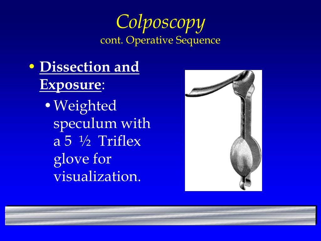 PPT Colposcopy PowerPoint Presentation, free download ID1703513