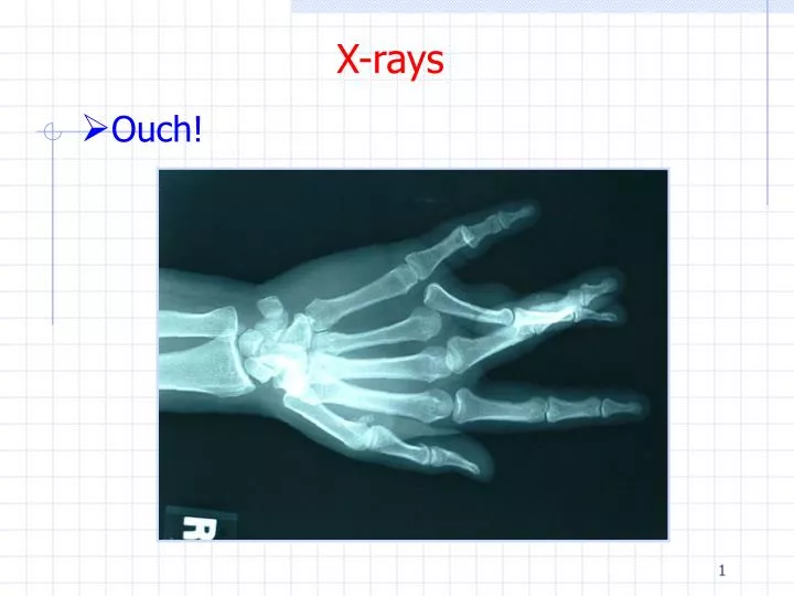 PPT Xrays PowerPoint Presentation, free download ID1712094