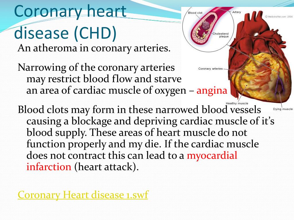 PPT - Understanding Heart Disease and Its Implications on ...