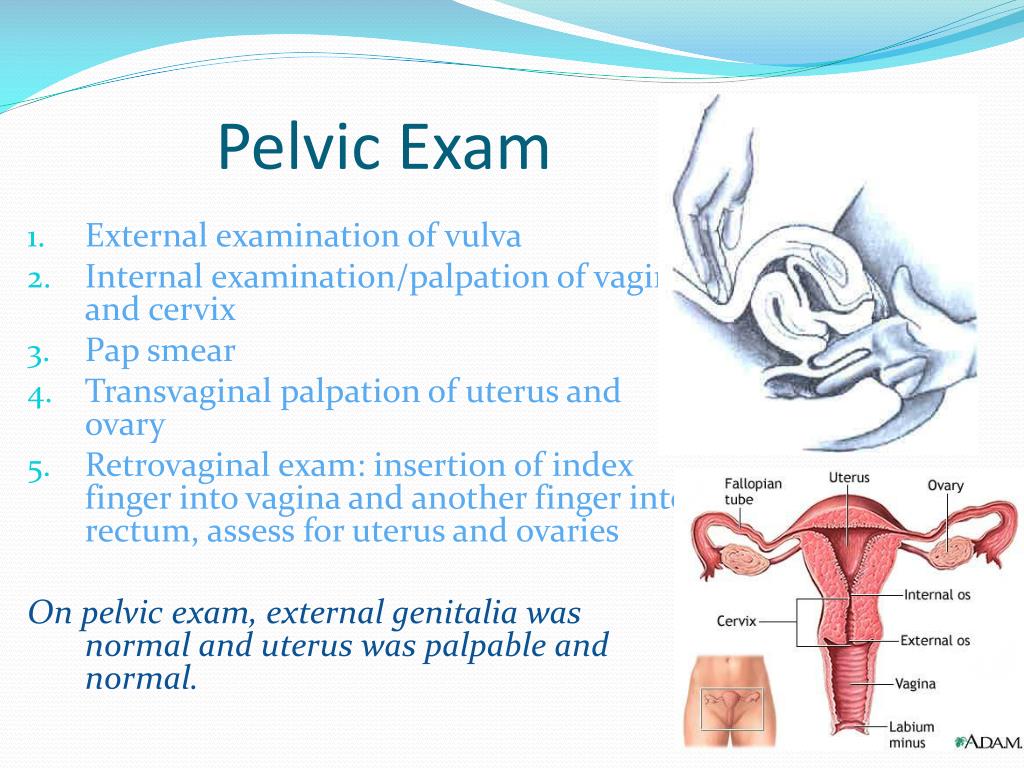 PPT Case 5 PowerPoint Presentation, free download ID1726796 PPT Case 5 PowerPoint Presentation, free download ID1726796