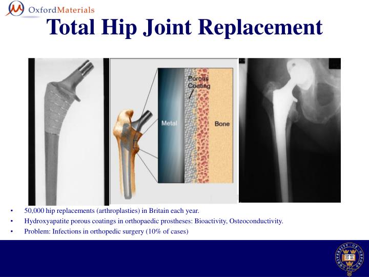 ppt asma yahyouche biomaterials group department of hip replacements materials