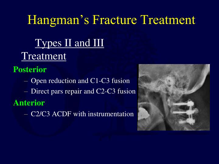 PPT - Upper Cervical Spine Fractures PowerPoint Presentation - ID:1733260