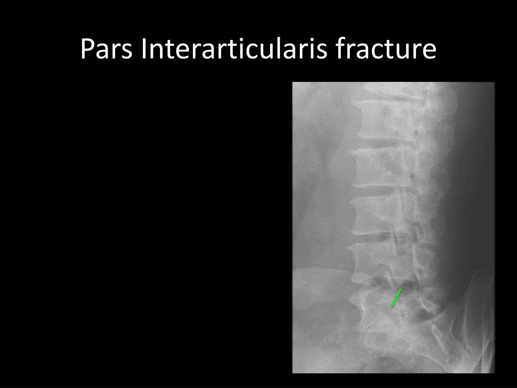 PPT Dx Imaging 3 Review PowerPoint Presentation Free Download ID PPT Dx Imaging 3 Review PowerPoint Presentation Free Download ID