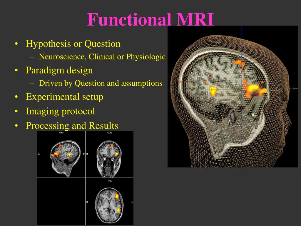 new research is using functional mri quizlet
