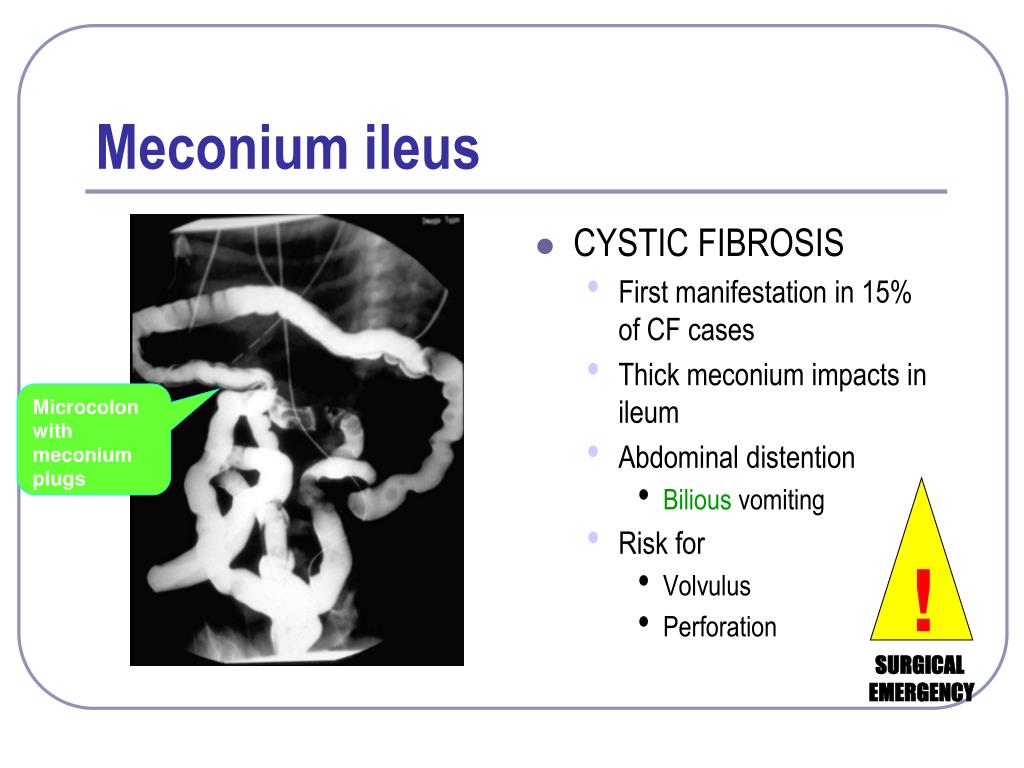 PPT Surgical Problems In Children PowerPoint Presentation Free 