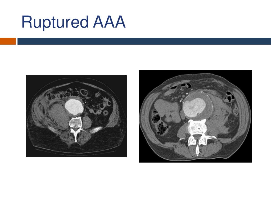 PPT Acute Surgical Conditions PowerPoint Presentation Free Download 