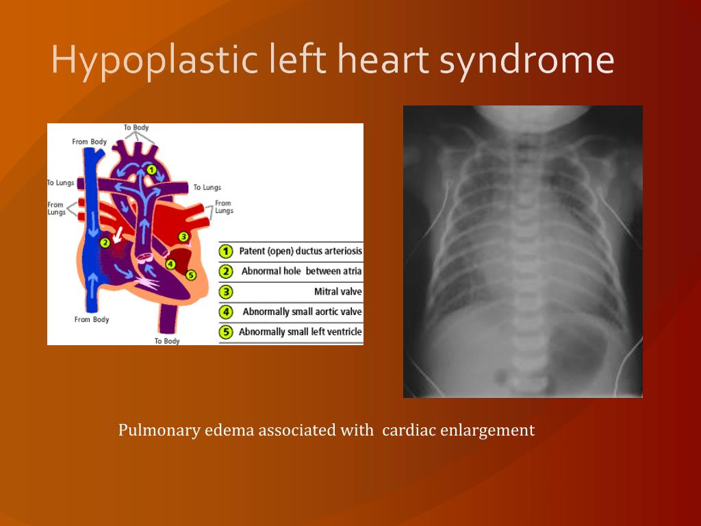 Ppt Board Review Cardiology Powerpoint Presentation Free Download