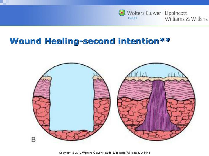 PPT Chapter 58 Special Skin and Wound Care PowerPoint Presentation