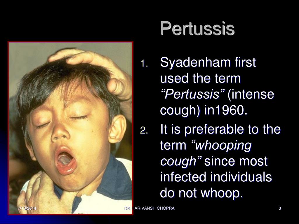 PPT  Pertussis (Whooping Cough) PowerPoint Presentation, free download