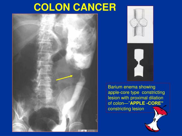 PPT GASTROINTESTINAL IMAGING PowerPoint Presentation ID1750356