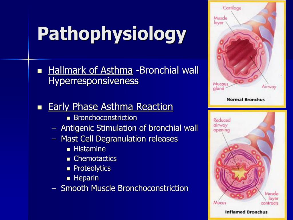 Asthma Pathophysiology PPT