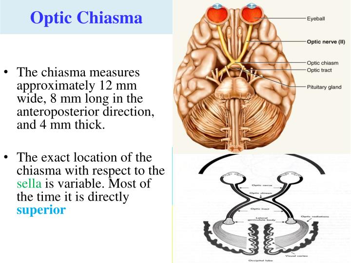 PPT Cranial nerves II,III, IV,VI and Visual Pathway PowerPoint