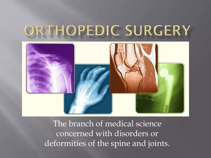 PPT Orthopedic Surgery PowerPoint Presentation Free Download ID 