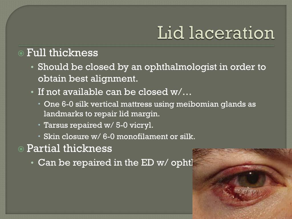 PPT Ocular Emergencies PowerPoint Presentation Free Download ID PPT Ocular Emergencies PowerPoint Presentation Free Download ID
