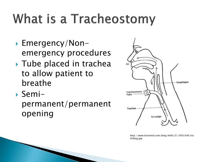 PPT Tracheostomy Tube S ecurity D evice PowerPoint Presentation ID