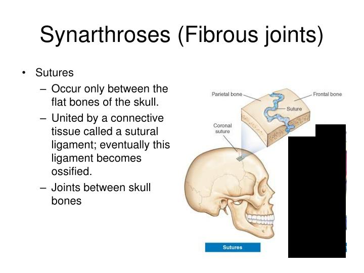 PPT - Articulations Chapter 9 PowerPoint Presentation - ID:1773420