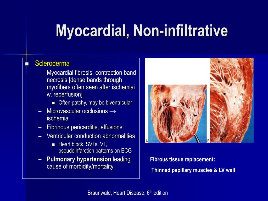 microvascular fragments meaning microvascular fragments meaning