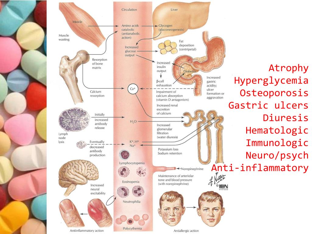 Ivermectin for human lice Ivermectin for human lice