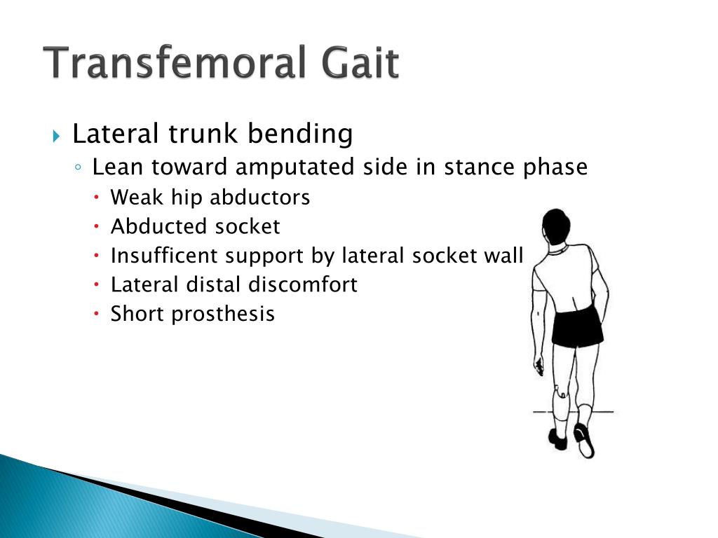 PPT - Gait Deviations in Transfemoral and Transtibial Amputees ...