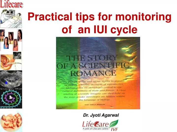 PPT Practical tips for monitoring of an IUI cycle PowerPoint