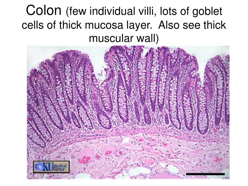 Ткани кишечника. Стенка Толстого кишечника гистология. Препарат толстой кишки гистология. Толстый кишечник гистология препарат. Эпителий толстой кишки гистология.
