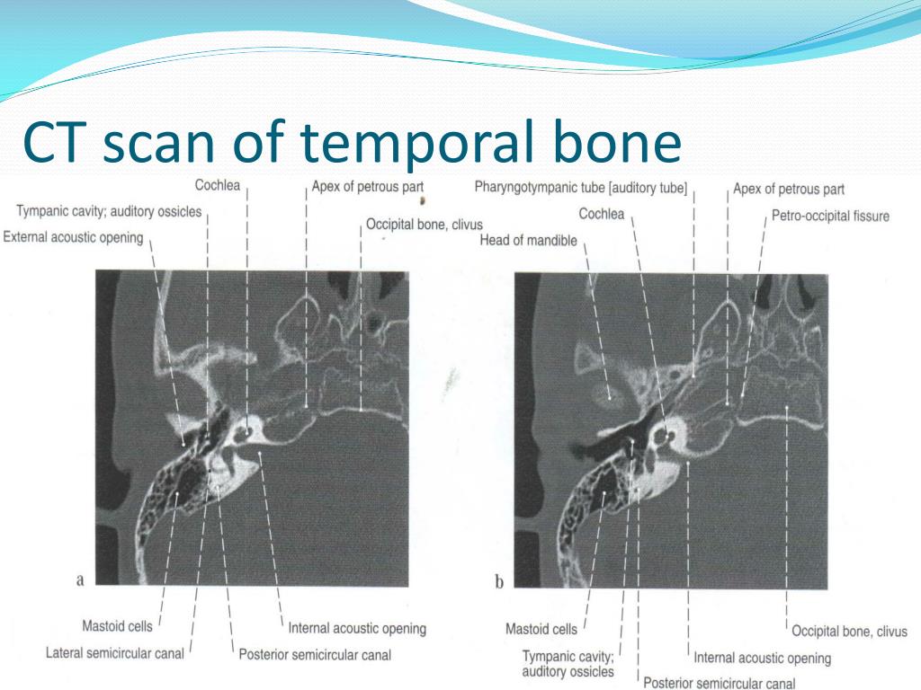 PPT - Clinical anatomy & physiology of the ear PowerPoint Presentation