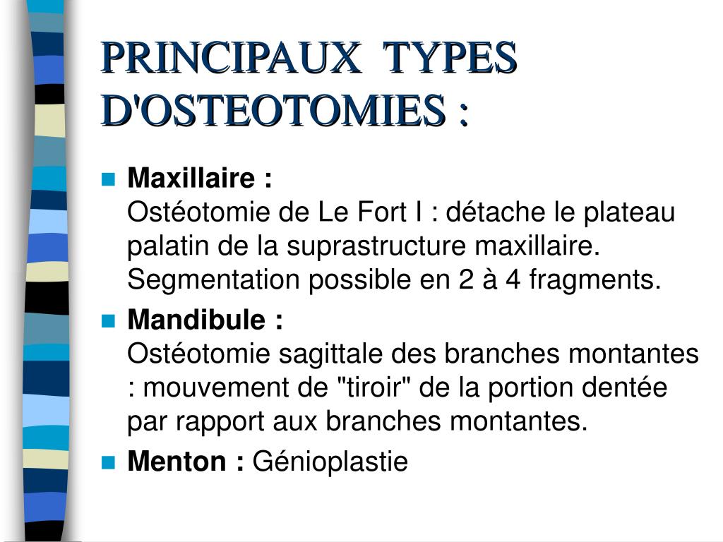 Quels sont les différents types d'ostéotomies