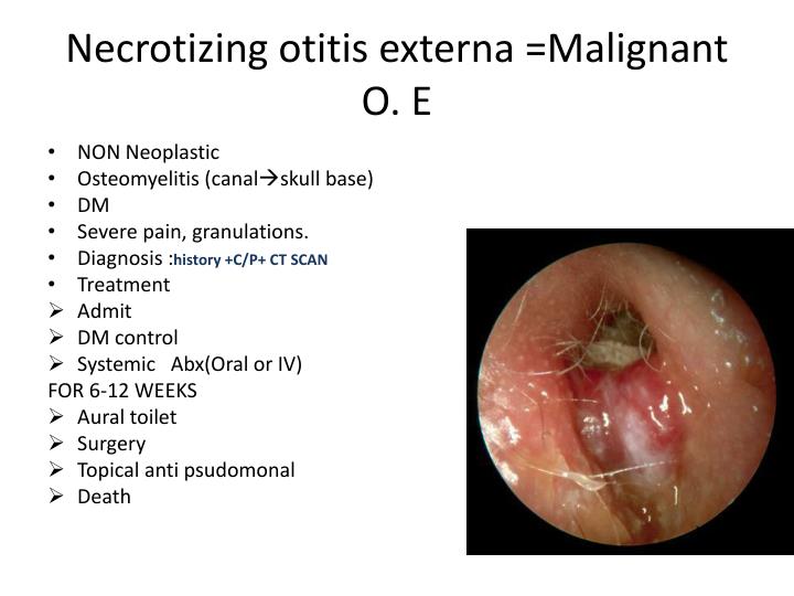 13 Possible Causes Of Dry Mouth
