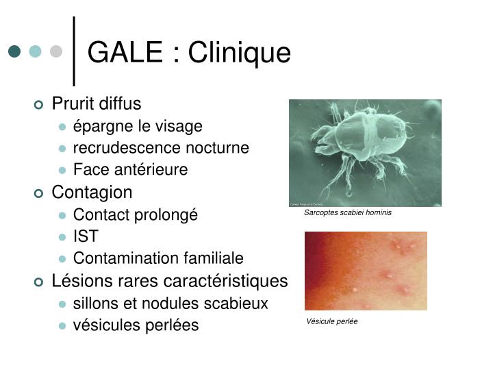 PPT PARASITOSES PowerPoint Presentation ID 1811197 ppt-parasitoses-powerpoint-presentation-id-1811197