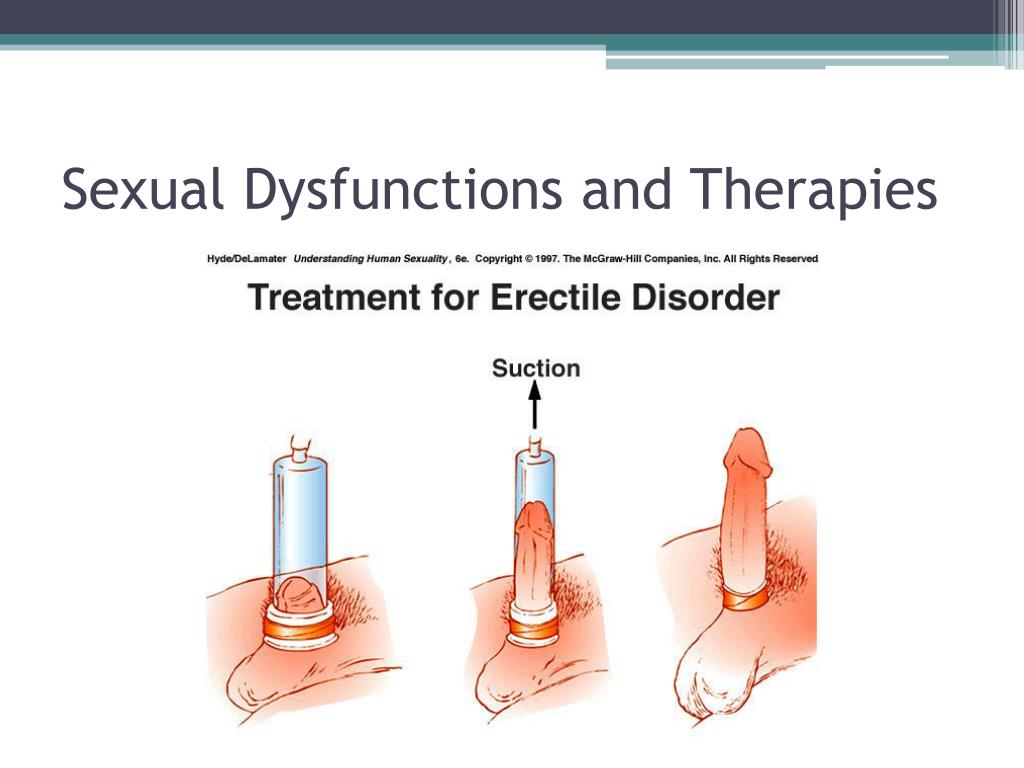 Pdf sex differences in learning comprehension