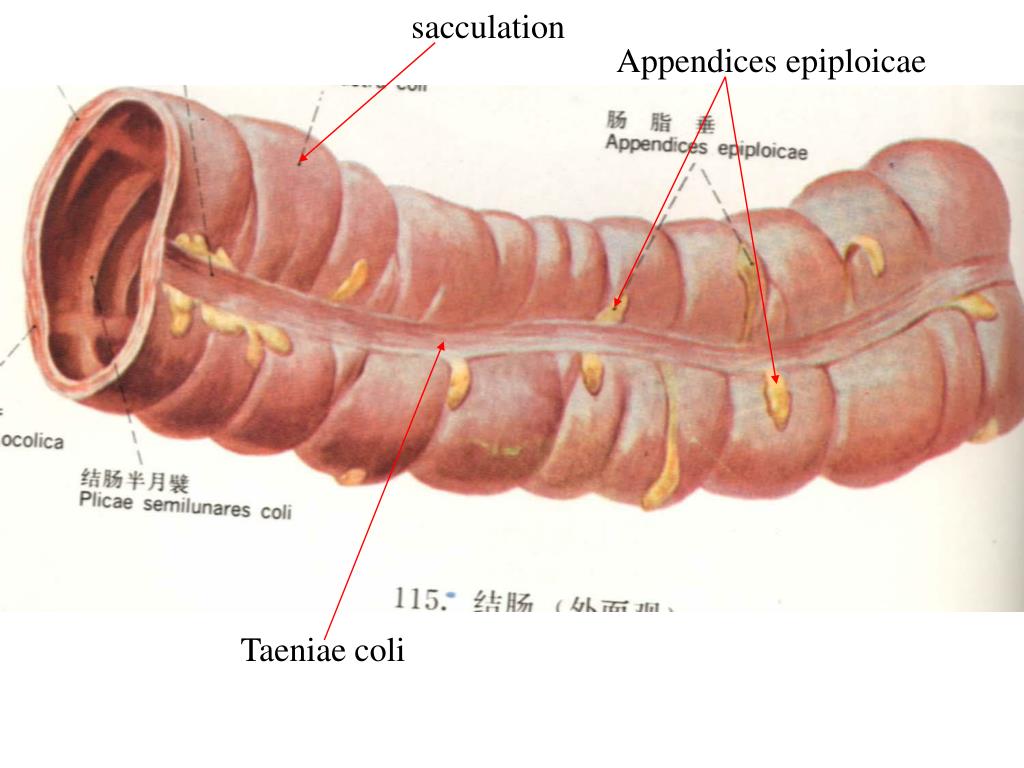 Apendagitis epiploica dieta Apendagitis epiploica dieta